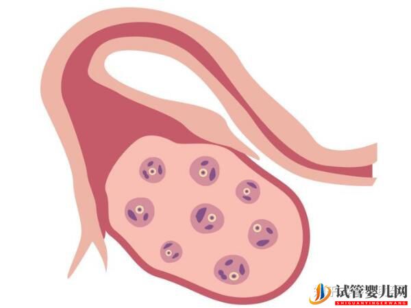 赴美試管嬰兒要經(jīng)歷哪些流程呢(圖3)