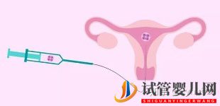 泰國三代試管生男孩可以健康活到幾歲(圖1)