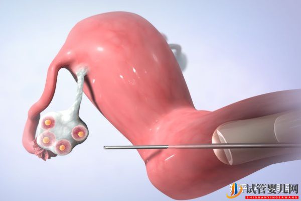 赴美做試管嬰兒的具體操作流程(圖9)