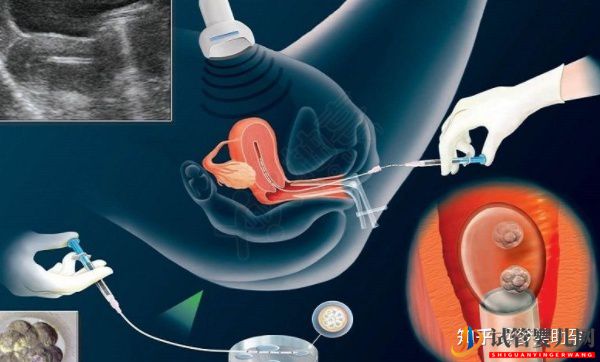 赴美做試管嬰兒的具體操作流程(圖13)