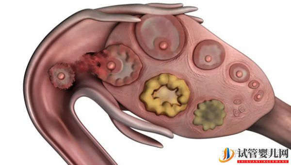 多次試管失敗,赴美試管成功率如何(圖3)