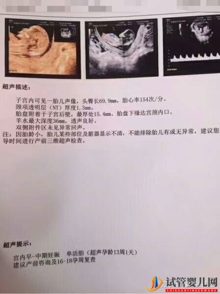 泰國試管嬰兒心路歷程(圖3)