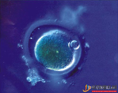 美國試管助孕可以挑選性別嗎(圖2)