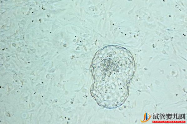 美國試管嬰兒技術正解-常見的4個問題解讀(圖3)