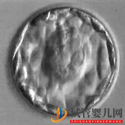 美國(guó)試管嬰兒這樣的囊胚才是極好的!(圖10)