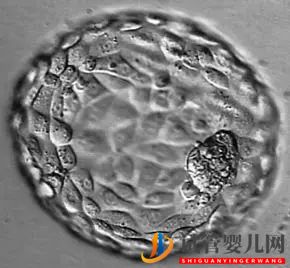 美國(guó)試管嬰兒這樣的囊胚才是極好的!(圖14)