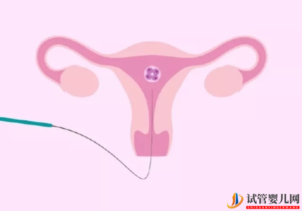 和田21個胚胎只養成3個囊胚咋回事？可能這些原因導致失敗(圖2)