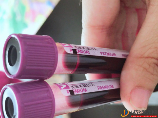 孕期奔赴香港驗血看男女讓人懊悔不已，簡直就是個坑(圖1)