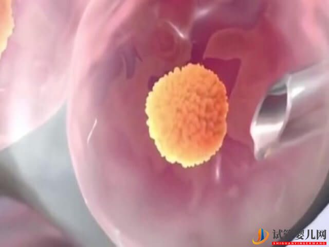 合肥901醫院試管移植一次大概需要準備多少錢？(圖2)