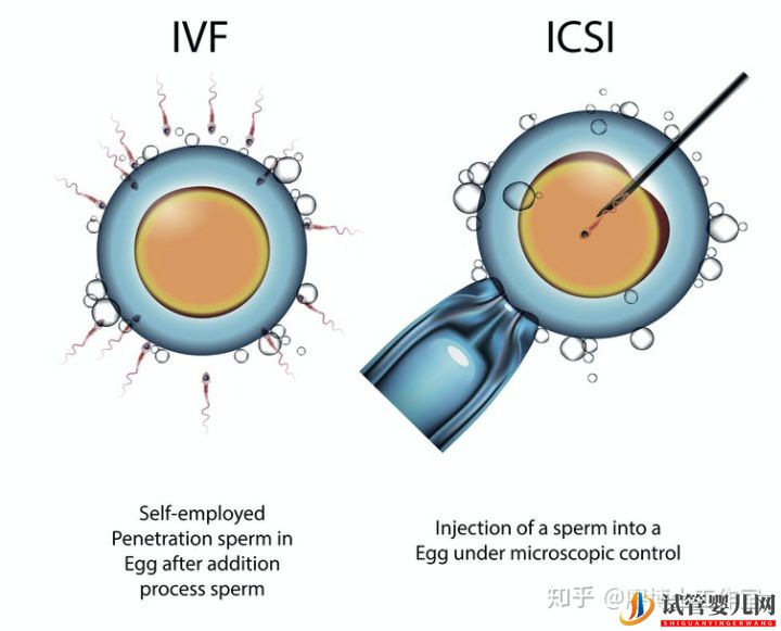 第三代試管嬰兒優(yōu)于第一代和第二代嗎？適合哪些人？試管大約多少錢？(圖1)