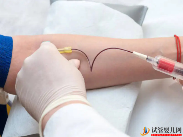 優生優育十項檢查項目匯總(圖1)