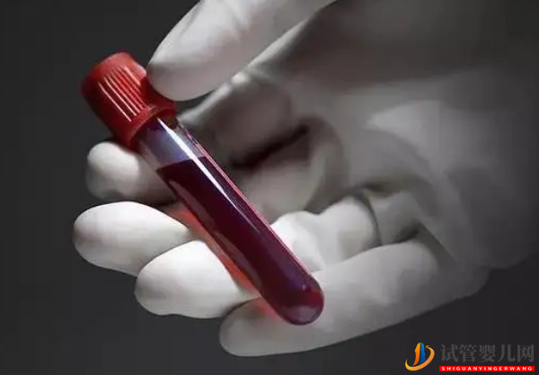 試管前檢查免疫風濕有原因，這5種情況下不可大意(圖2)