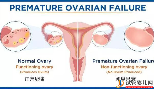 amh0.22卵巢早衰幾率大(圖1)