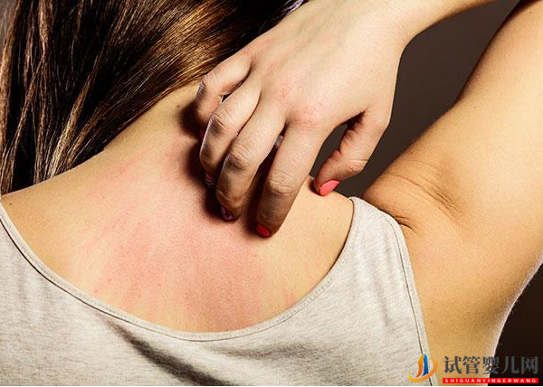 過敏體質對試管的影響別不知，移植前注意這兩大事項才是真(圖1)