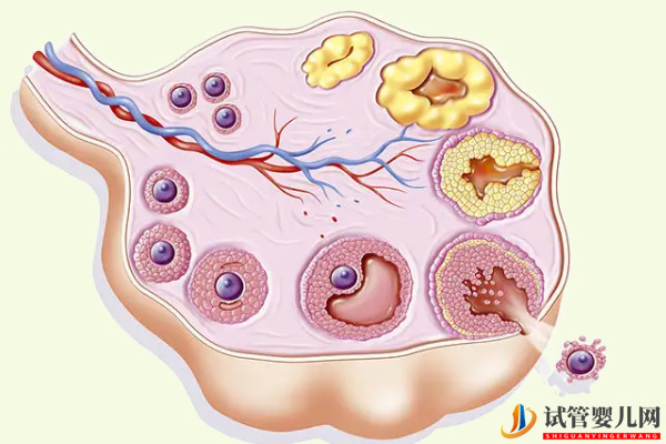 排卵障礙做試管選擇合適方案能提高懷孕率(圖1)