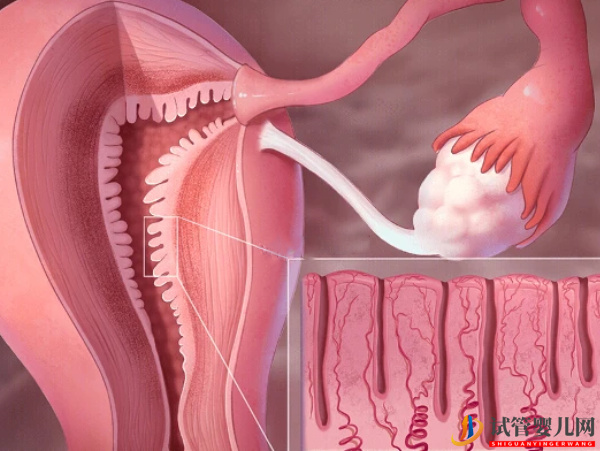 子宮內膜厚對試管的影響別忽視，要不要刮宮？(圖1)