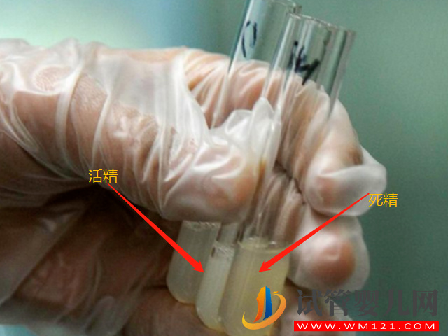 男性死精和活精差異盤點，一張圖帶你兩者表面區(qū)別(圖1)