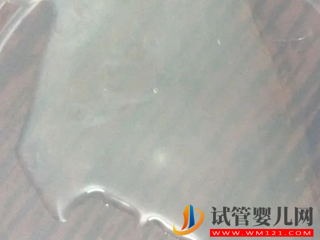 男性死精和活精差異盤點，一張圖帶你兩者表面區(qū)別(圖2)