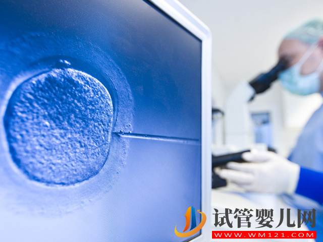 雙腔取卵與單腔取卵區別很大，這3種情況必須雙腔取卵(圖1)