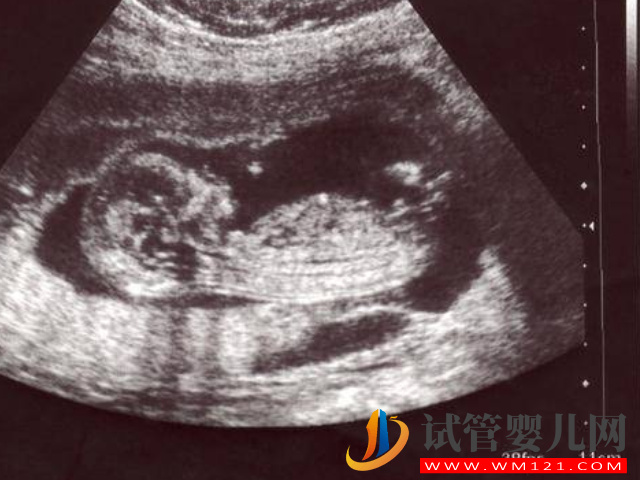 四維彩超數據和圖片看男女超準，這些看男女小技巧全教給你(圖1)