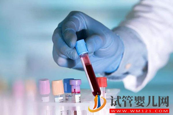 喝豆?jié){三個月睪酮降了是正常現(xiàn)象，會不會升高因人而異(圖3)