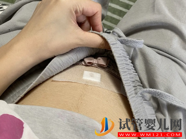 孕期胎兒畸形的10大征兆早知道：下腹痛、流血需及時檢查(圖3)