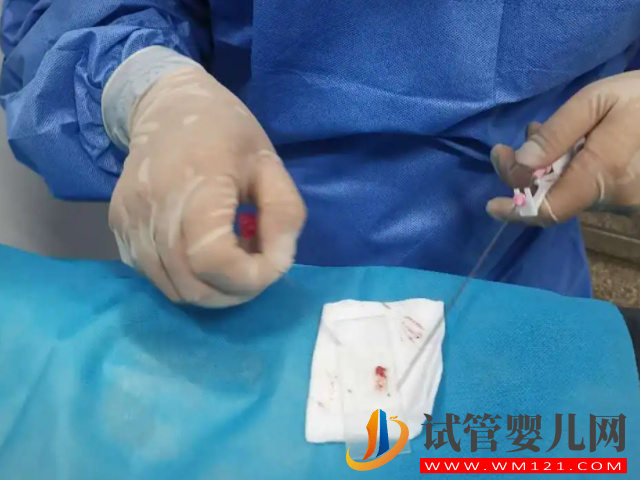 睪丸穿刺手術費用清單，術前檢查+手術費不超過這個數(圖2)