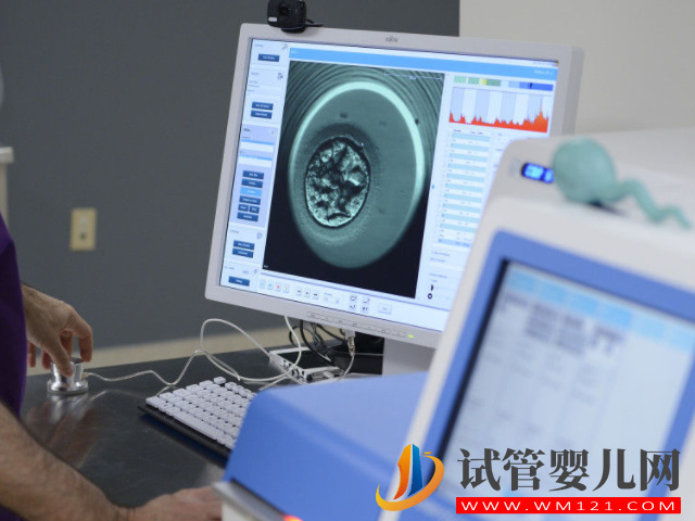 卵泡穿刺手術過程及費用詳解，不同醫院差異化較大(圖2)