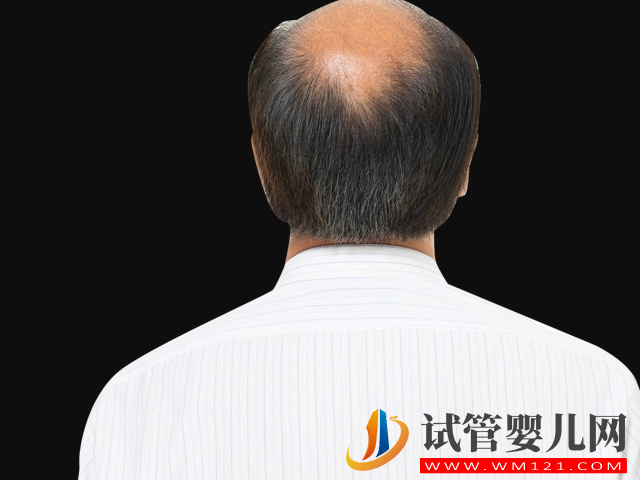 4種傳男不傳女的遺傳病盤點，如有必要請選擇第三代試管助孕(圖3)