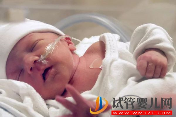 試管三胎必須減胎原因匯總，多胎并發癥多對胎兒影響大(圖3)