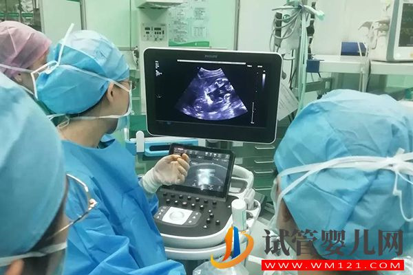 多囊促排懷雙胞胎注意事項(xiàng)匯總，定期產(chǎn)檢發(fā)現(xiàn)異常可減胎(圖3)