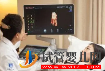 四維單子上3個亮點是男孩 思維單子怎么看男看女(圖2)