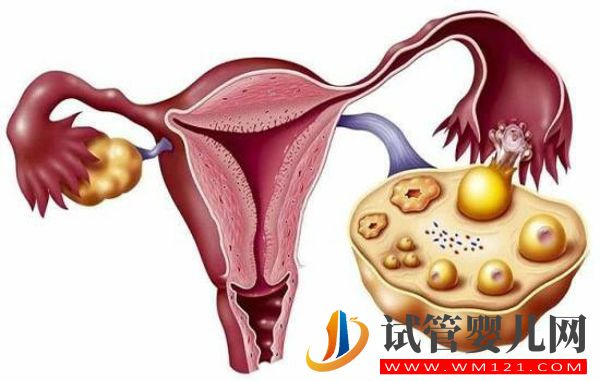 幼稚子宮必做檢查項目一覽，4項診斷標準一定要注意了(圖3)
