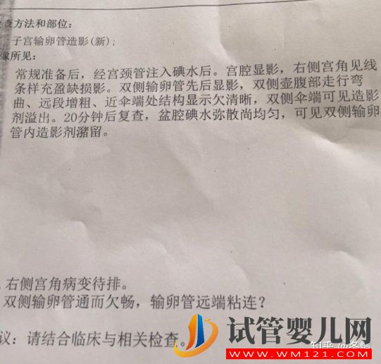 45歲試管嬰兒一次成功案例分享(圖2)