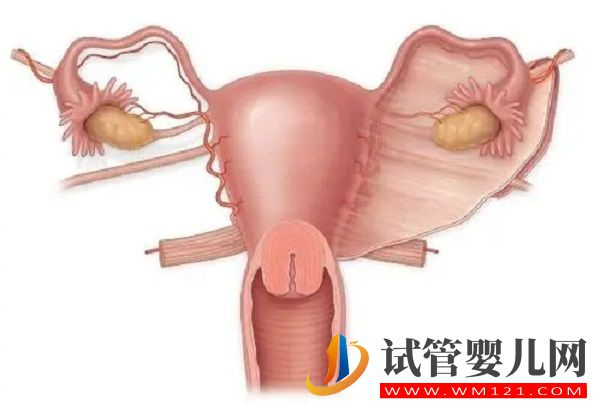 子宮腺肌癥潛伏的5大誘因，生活中防不勝防(圖4)