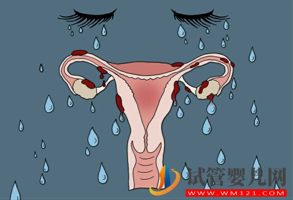 子宮切除的好處、壞處大盤點，這8大后遺癥有重大危害(圖1)