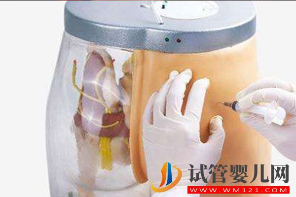 hmg治療卵泡萎縮效果好，注射也需謹(jǐn)慎(圖3)