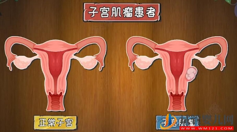 影響試管嬰兒成功率的子宮內(nèi)環(huán)境有哪些(圖2)