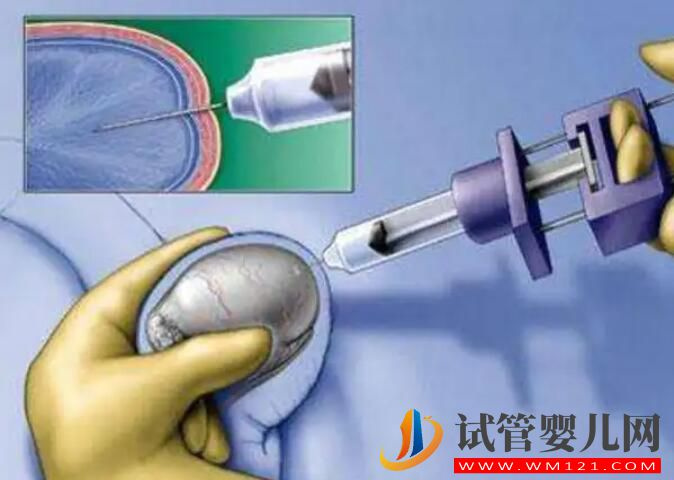 男性不孕隱蔽問題，精子DNA斷裂怎么辦？(圖2)