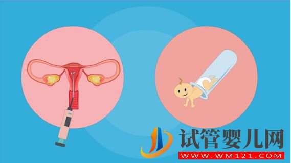 人工授精和試管嬰兒詳細(xì)介紹及對比？(圖3)