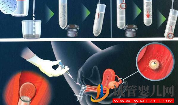 試管嬰兒的出發點和原理是什么？想要了解的進來看看了(圖2)