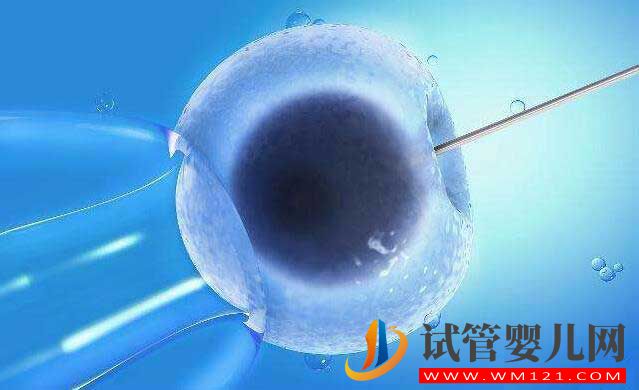 做試管嬰兒整個環節有哪些？(圖1)