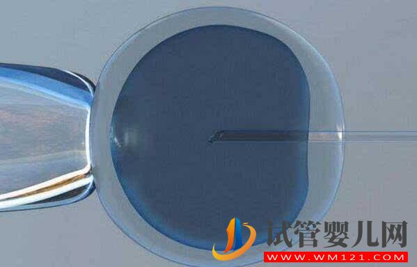 解答做試管嬰兒的人非常擔心的幾個問題(圖5) 解答做試管嬰兒的人非常擔心的幾個問題(圖5)
