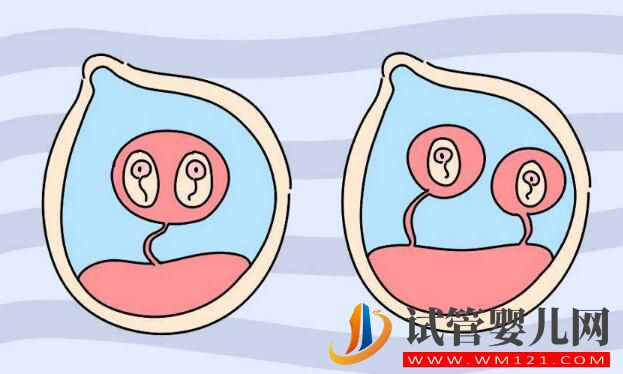 俄羅斯試管嬰兒攻略 看看有哪些你不知道的(圖2)