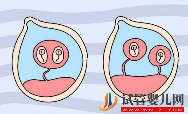 做試管嬰兒要選擇季節(jié)嗎？多大年紀來做會更好？(圖4)