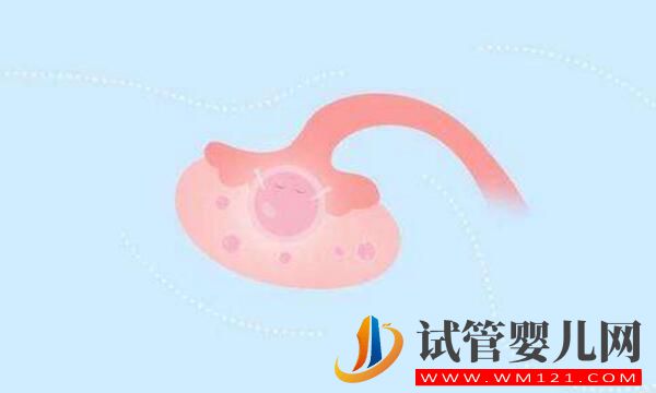 做試管嬰兒促排出現空卵泡是為什么？該怎么辦(圖3)