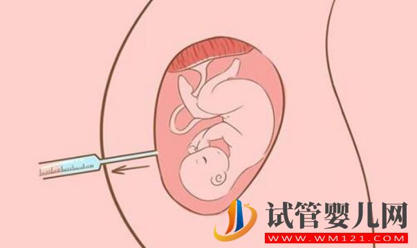 女性40歲適合做試管嬰兒嗎？做試管需要注意什么(圖3)