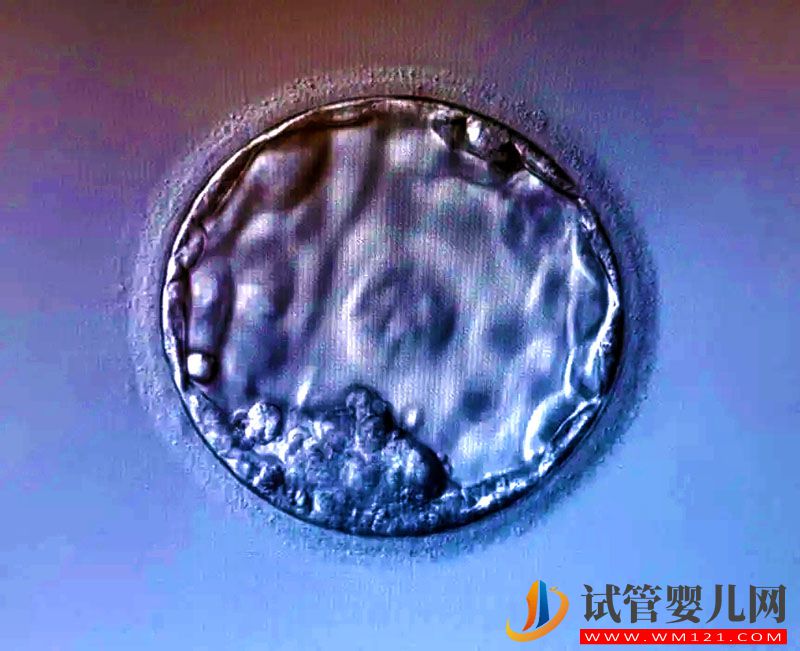 做試管養囊失敗的原因有哪些(圖3)