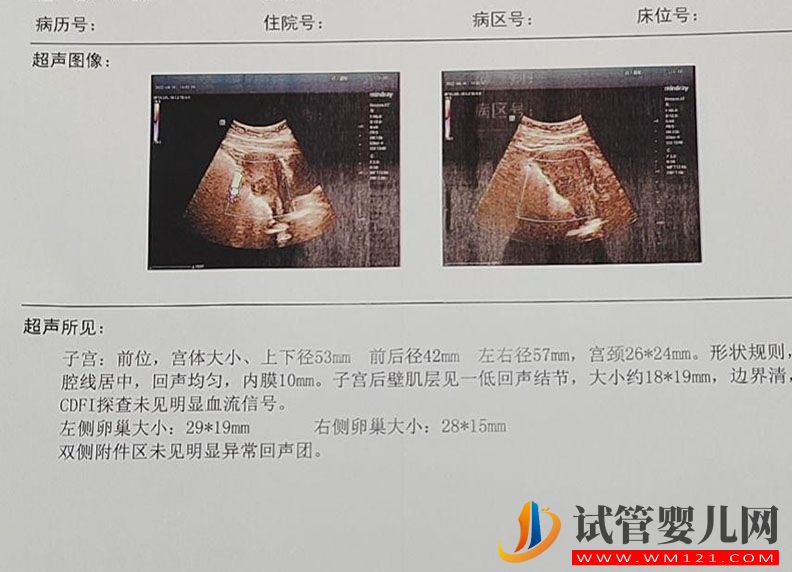 朋友給供卵做試管要多少錢(圖3)