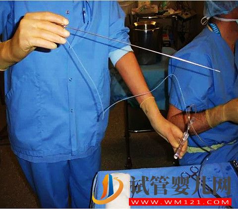 1640686536537184.jpg 做試管嬰兒取卵痛不痛?不麻醉半麻和全麻有哪些區(qū)別?(圖2)